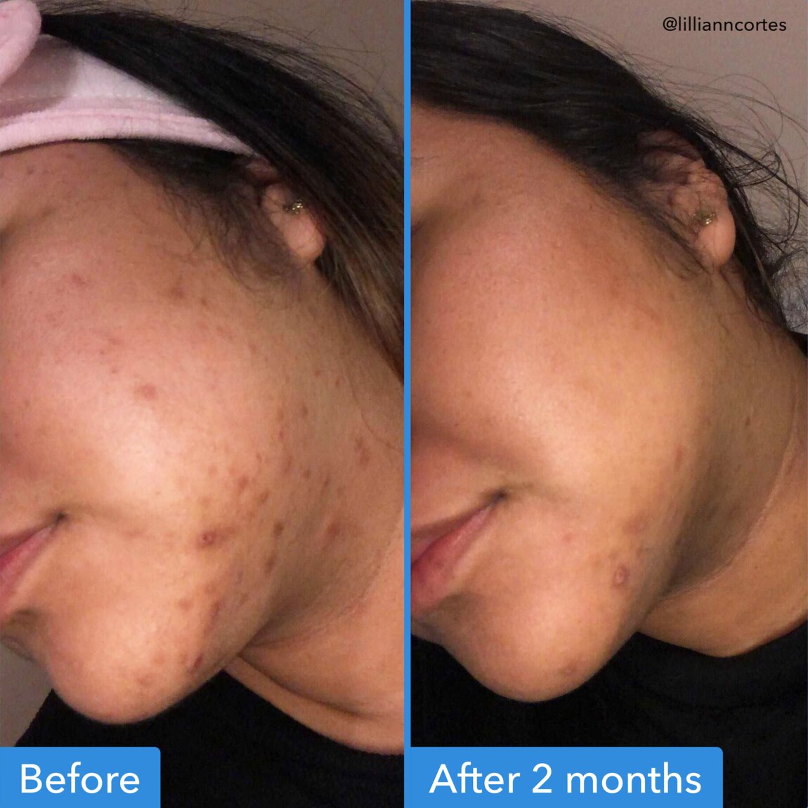 discoloration-correcting-serum-t2 zb_p.jpg