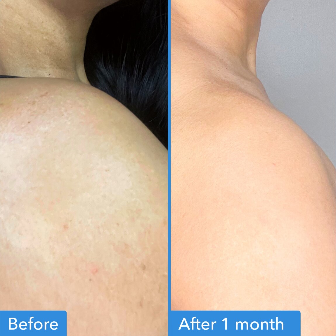 discoloration-correcting-body-treatment-j3 zb_p.jpg
