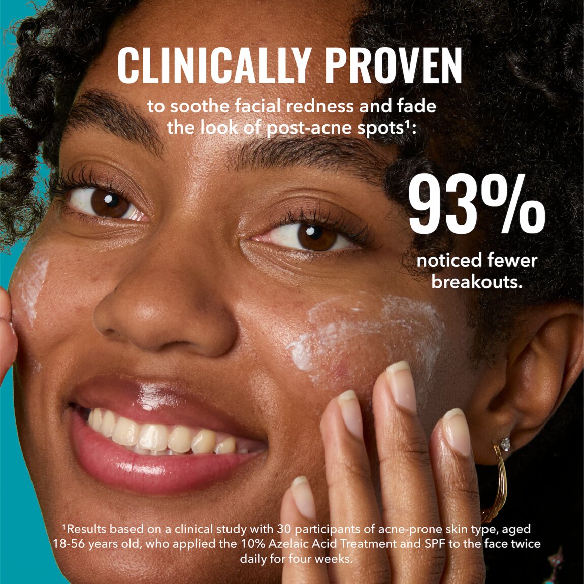 10-azelaic-acid-treatment-a6 zb_p.jpg